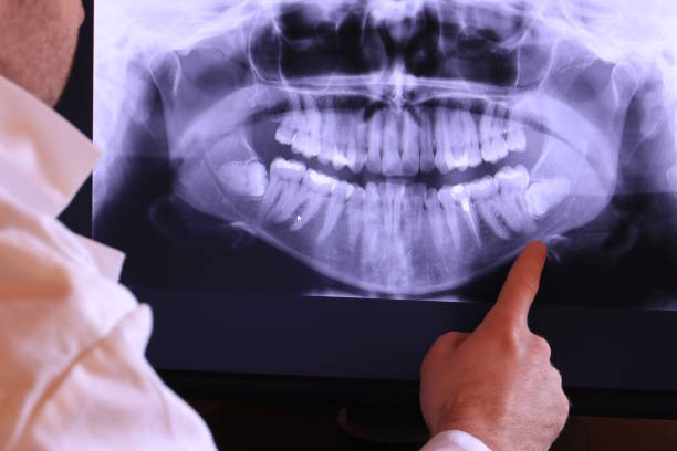 Best Emergency Treatment for Jaw Pain or Injury in Mentone, CA